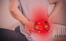 Vừa uống nước xong đã "mắc" đi vệ sinh do 4 nguyên nhân dễ hiểu này, nếu vướng phải điều số 4 phải đi khám ngay vì thận đang gặp nguy