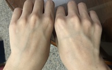 Cơ thể xuất hiện 5 thay đổi này đồng nghĩa với việc các cơ quan nội tạng đã bắt đầu bị lão hóa!