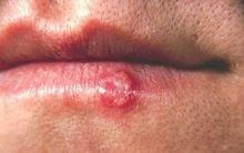 Sau 8 tiếng, loại virus này sẽ chui vào não và nó sẽ trở thành bất tử