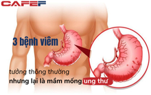 1/6 số ca ung thư trên thế giới xuất phát từ nhiễm trùng: 3 bệnh viêm tưởng như thông thường nhưng lại là "sát thủ thầm lặng"