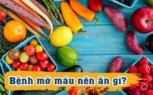 Mỡ máu cao là "kẻ giết người thầm lặng": 4 loại thực phẩm quen thuộc với mọi nhà giúp "gột sạch" mạch máu, điều hòa tim mạch