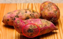 2 loại thực phẩm tích trữ trong bếp là "chất xúc tác" gây bệnh xơ gan, bạn nên vứt ngay trước khi quá muộn