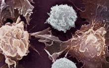 Ung thư cũng có "kẻ thù không đội trời chung": Ăn một ít mỗi ngày có thể khiến tế bào ung thư khiếp sợ!