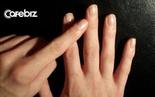 Gan yếu, tích tụ nhiều độc tố, dễ chuyển biến thành ung thư: Khi NGÓN TAY GIỮA xuất hiện 4 điểm bất thường, cần đi khám ngay!