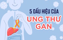 Không phân biệt nam hay nữ, chỉ cần có 3/5 biểu hiện bất thường này thì ung thư gan đã âm thầm gõ cửa: Đi khám ngay kẻo hối hận không kịp!