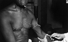 Thí nghiệm Tuskegee: một trong những dự án phi đạo đức nhất lịch sử