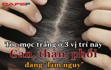 Tóc đang “đen nhánh” nhưng lại bạc trắng ở 3 vị trí này thì chứng tỏ gan, thận, phổi của bạn đang “lâm nguy”, khám sớm kẻo hối hận không kịp