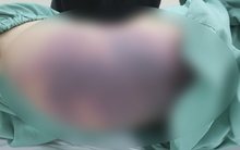 UBND quận báo cáo khẩn vụ bé 8 tuổi bị bạo hành: Bố đưa đi viện khâu vết thương vùng đầu ngày 11/12