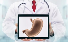 3 thực phẩm TRẮNG là "tác nhân" gây ung thư dạ dày, chuyên gia kêu gọi tránh xa!