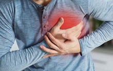 Đừng chủ quan với kiểu đau ngực sau: Rất có thể đây là "triệu chứng vàng" cảnh báo đột tử
