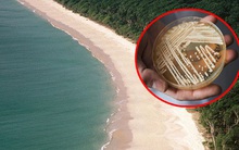 Siêu khuẩn kháng thuốc nguy hiểm chết người lần đầu tiên trong lịch sử được tìm thấy ở một nơi không ai ngờ tới