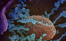 Sóng siêu âm có thể tiêu diệt virus SARS-CoV-2