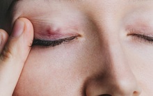 Sáng ngủ dậy gặp 4 điều bất thường thì rất có thể sức khỏe của bạn đang bị đe dọa