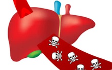 Chủ tịch Hội Ung thư: Người Việt có 2 thói quen cực xấu, làm cả 2 cùng lúc nguy cơ ung thư tăng rất cao