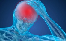 Cảnh báo mới: COVID-19 có thể chặn oxy đến não, kích hoạt một “tác dụng phụ đáng sợ”