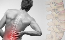 Chuyên gia BV Việt Đức chia sẻ 7 bí quyết bỏ túi để bảo vệ cột sống