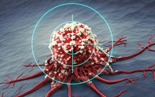 1/6 bệnh nhân mắc ung thư đều do viêm: Nếu có 5 vị trí này trên cơ thể bị viêm thì bạn hãy cảnh giác bệnh ung thư đang đến gần