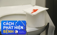 Tự kiểm tra sức khỏe thông qua màu phân: Nếu có một trong số những dấu hiệu sau thì đồng nghĩa bạn rất dễ mắc bệnh