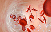 4 loại bữa tối nhiều người thích ăn nhưng lại có thể phá hủy mạch máu