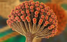 Thứ phá hủy gan còn nguy hiểm hơn rượu, WHO xếp hạng là tác nhân gây ung thư nhóm 1 nhưng nhiều gia đình không biết vẫn dùng