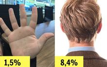 13 đặc điểm cơ thể hiếm gặp chỉ ít người trên thế giới sở hữu, nếu bạn cũng có thì chắc chắn thuộc nhóm những người đặc biệt nhất