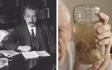 Những vĩ nhân thân xác không còn nguyên vẹn sau khi mất: Não của Einstein thậm chí bị cắt thành 240 mảnh