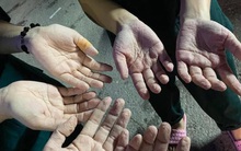 Chuyện về những đôi bàn tay, bàn chân trắng bệch vì “ngâm mồ hôi” của y bác sĩ nơi tuyến đầu