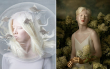 Cô bé bị bố mẹ nhẫn tâm bỏ rơi vì mắc bạch tạng, 16 năm sau lột xác trở thành người mẫu đình đám với thần thái hút hồn hiếm thấy