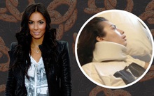 Câu chuyện của nữ người mẫu bị dị ứng sau khi ăn bánh quy tẩm bơ lạc, được bồi thường 670 tỷ nhưng liệt tứ chi, tổn thương não