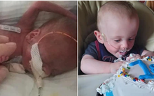 Bé trai sinh non tới hơn 4 tháng, sớm nhất thế giới với tỉ lệ sống sót là 0% và kết cục khiến cả thế giới phải trầm trồ