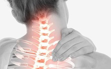 Nhận biết và phòng ngừa thoái hóa đốt sống cổ