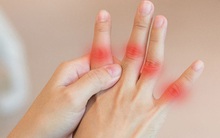 4 dấu hiệu ở tay giúp bạn nhận biết phổi của mình đang ổn hay không, nếu có đủ cả 4 thì nên đi kiểm tra phổi ngay