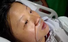 1 người chết, 1 người phải sống nhờ máy thở suốt phần đời còn lại vì bị viêm phổi kẽ chỉ 2 tháng sau khi nhuộm tóc