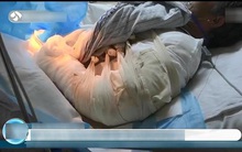 Người đàn ông bị "rút cạn" 2/3 lượng máu trong cơ thể, suýt chết vì 1 hành động chủ quan mà nhiều người mắc phải