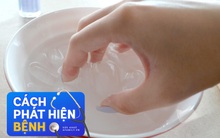 Hãy làm ngay 6 cách tự kiểm tra sức khỏe tổng thể tại nhà: Chỉ mất vài phút mà cứu tương lai khỏi bệnh tật