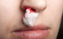 Người có gan kém rất dễ gặp 4 vấn đề ở vùng đầu, nếu có 1 cũng phải chú ý ngay