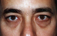 4 bộ phận cơ thể chuyển màu sẫm, hãy cẩn trọng bởi đó là dấu hiệu của bệnh tật đã cận kề