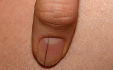 "2 đen, 2 mùi" là dấu hiệu cảnh báo gan có vấn đề, mong rằng bạn không có cái nào