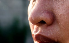 8 bộ phận này của cơ thể bất ngờ đẫm mồ hôi thì phải đặc biệt chú ý, nhất là khi mồ hôi có "mùi lạ", màu vàng - đỏ - trắng