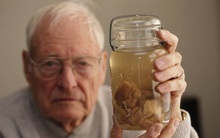 Chuyến phiêu lưu của bộ não Albert Einstein, người có IQ cao nhất thế giới sau khi nó bị đánh cắp khỏi cơ thể