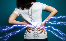 3 dấu hiệu bất thường ở vùng lưng cho thấy tế bào ung thư gõ cửa, mong rằng bạn không có triệu chứng nào