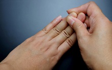 Bác sĩ nhắc nhở: Nhận thấy 4 điều bất thường này ở tay thì có thể phổi đang “kiệt quệ”, nặng hơn có thể dẫn đến ung thư