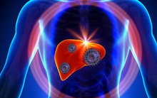 Đi ngủ sau 12 giờ đêm: 5 mối nguy hại này sẽ ập đến đầu tiên, hãy điều chỉnh lại thói quen và nghỉ ngơi càng sớm càng tốt