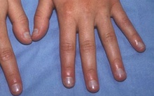 Một hành động tưởng vô nghĩa nhưng lại giúp bạn nhận biết nguy cơ mắc ung thư phổi từ sớm, không tin làm thử ngay!