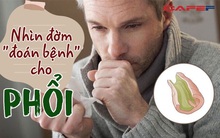 Nhìn đờm "đoán bệnh": 5 màu sắc của đờm "tiết lộ" phổi lâm nguy, biết sớm khám ngay thì tuổi thọ được kéo dài, chẳng sợ tử thần gõ cửa