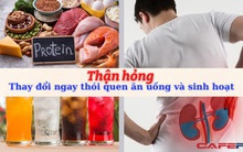 Chàng trai mới 30 tuổi nhưng thận đã hư hỏng nặng, thủ phạm là 2 thói quen khiến thận "chết dần chết mòn": Thực hiện đủ 5 lưu ý để luôn khỏe mạnh