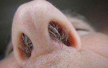 Lông ở bộ phận này bỗng nhiên chuyển từ đen sang trắng thì phải chú ý: Gan nóng, thận yếu, cơ thể suy nhược trầm trọng, thay đổi lối sống ngay để tuổi thọ được kéo dài, bệnh tật tránh xa