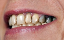 3 vùng trên cơ thể có dấu hiệu "thâm đen" ngầm cảnh báo bệnh gan đang hình thành, mong rằng bạn không có