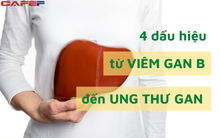 4 dấu hiệu báo động viêm gan B đang chuyển biến thành ung thư gan: Có nhiều hơn 1 thì nên cấp tốc đến gặp bác sĩ, kẻo lỡ thời điểm vàng chữa trị
