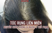 4 thủ phạm khiến tóc rụng liên miên, chưa già đã sắp hói: Là thói quen của nhiều người bỏ ngay đi trước khi tốn tiền triệu để phục hồi